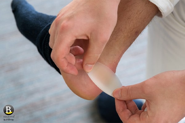 رفه زدگی پا در انواع کفش ها